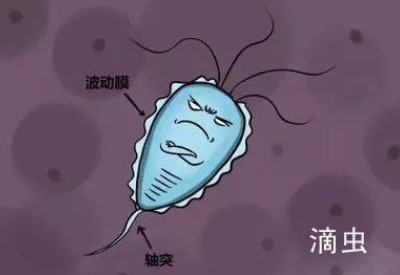 白帶黄瓜视频免费下载品牌介紹滴蟲性陰道炎的早期症狀以及預防方法