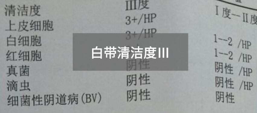 今天快訊！全自動白帶91黄瓜视频下载生產廠家黄瓜成视频人APP為您官方解釋白帶清潔度3的意思
